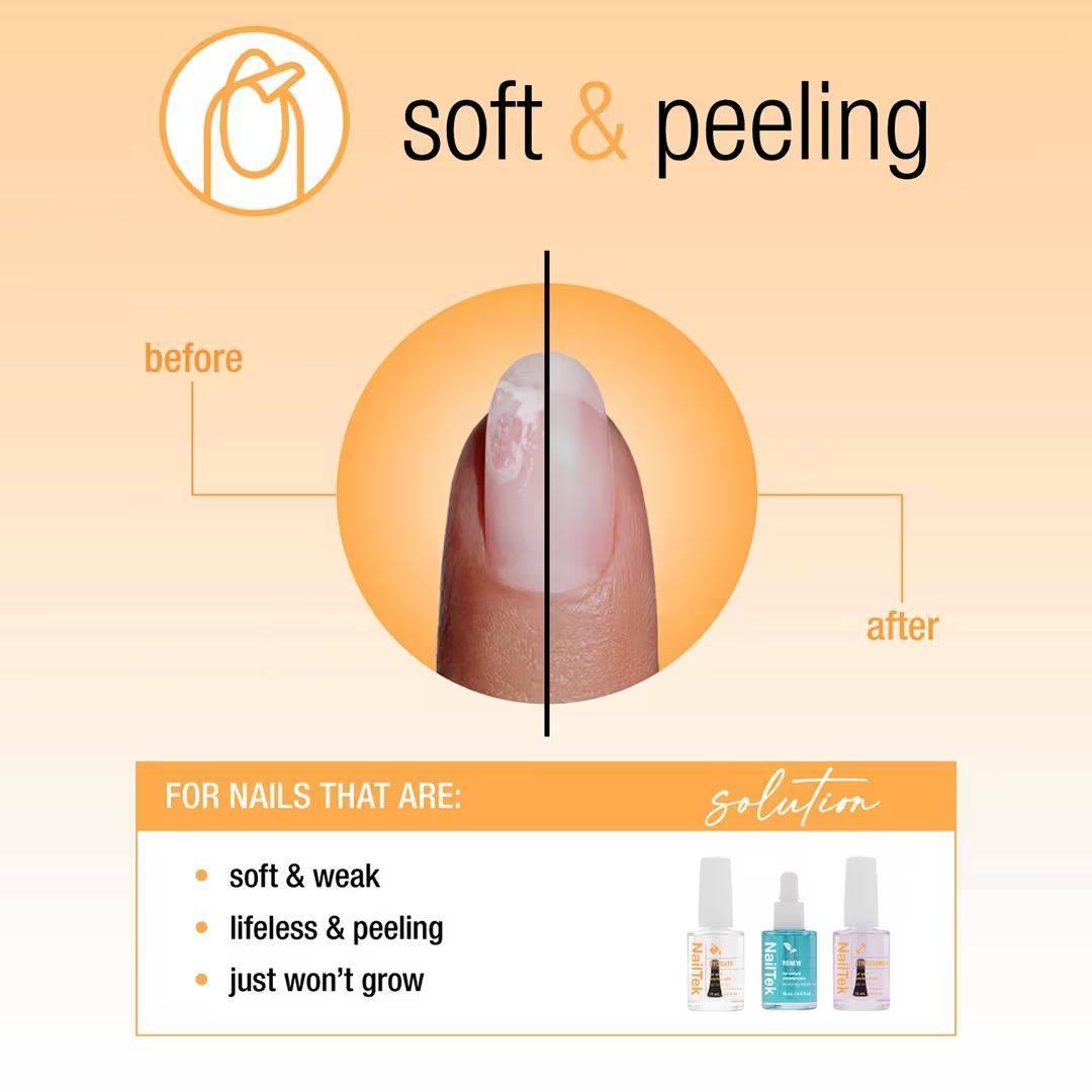 Nail Tek - Nail Recovery System Kit - Nail Treatment at Beyond Polish