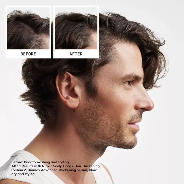 Nioxin Shampoo, Conditioner, Scalp Treatment - System Kit 2 - Hair at Beyond Polish