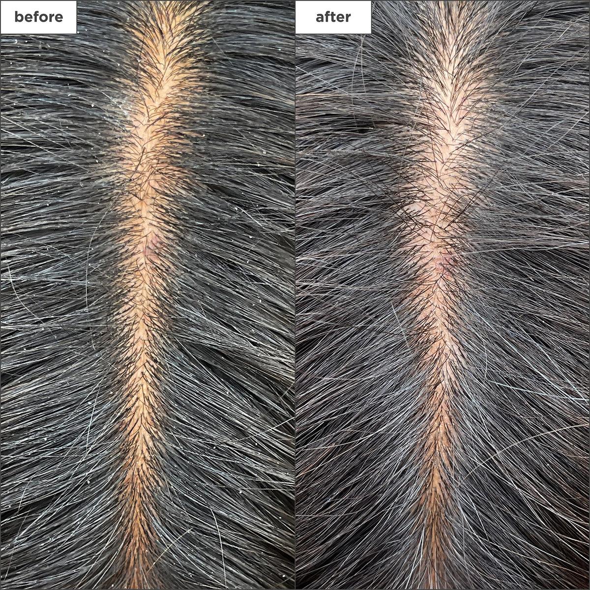 Briogeo - Scalp Revival Charcoal + Tea Tree Scalp Treatment 1 oz Drops - Hair at Beyond Polish