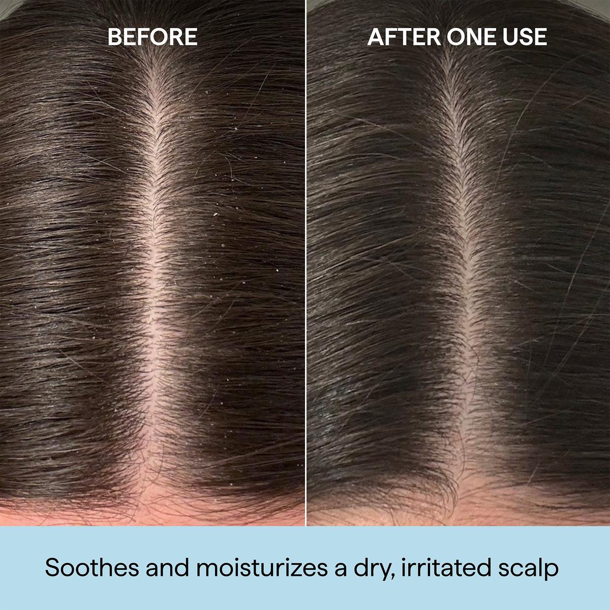 Briogeo - Scalp Revival™ Rosemary Pre-Wash Oil 5 oz Jumbo - Hair at Beyond Polish