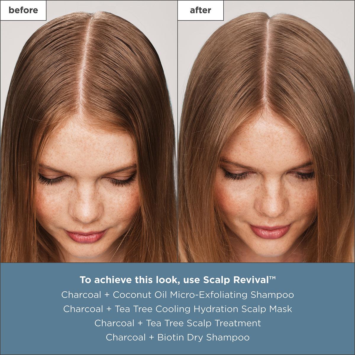 Briogeo - Scalp Revival Charcoal + Tea Tree Scalp Treatment 1 oz Drops - Hair at Beyond Polish