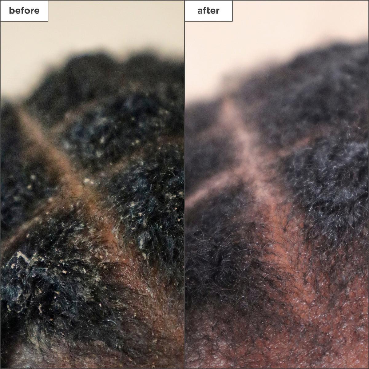 Briogeo - Scalp Revival Charcoal + Tea Tree Scalp Treatment 1 oz Drops - Hair at Beyond Polish