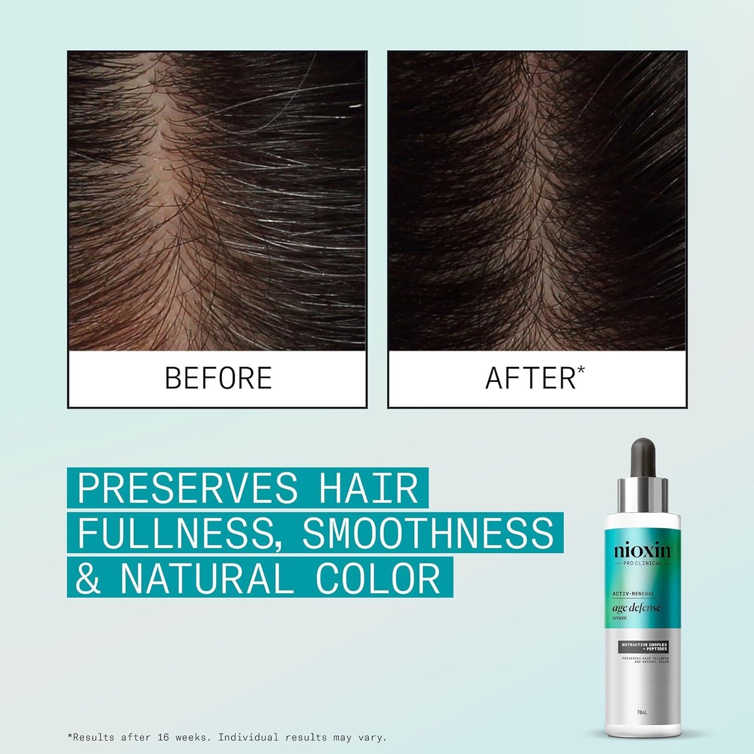 Nioxin - Age Defense Activ-Renew Regimen Kit - Hair at Beyond Polish