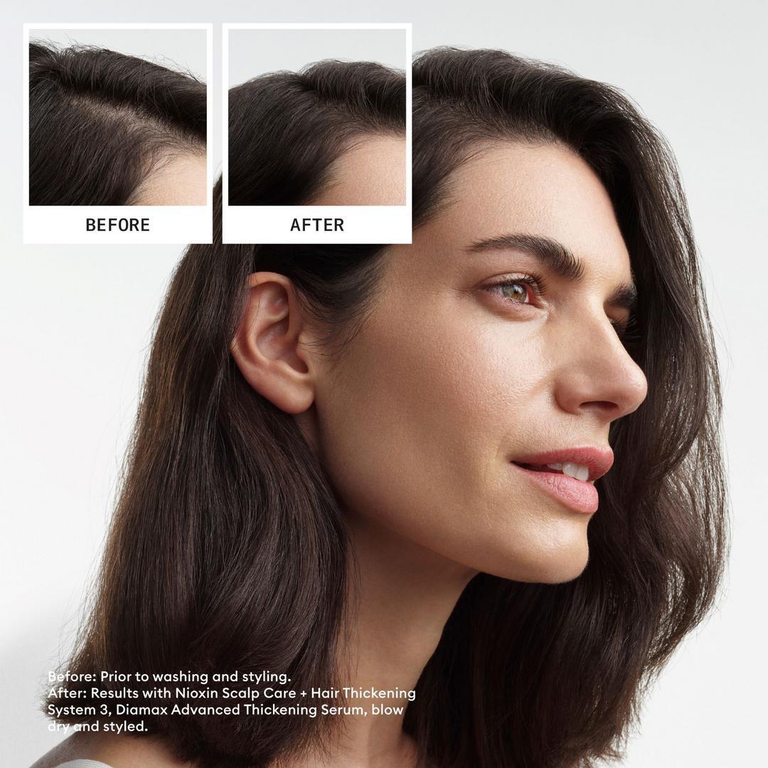 Nioxin - Scalp + Hair Thickening System 3 Leave on Treatment 100 ML - Hair at Beyond Polish